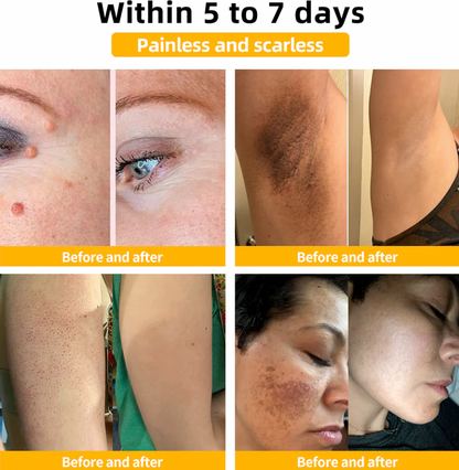 Bee Venom Skin Elixir